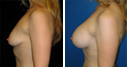 Before & After Photos